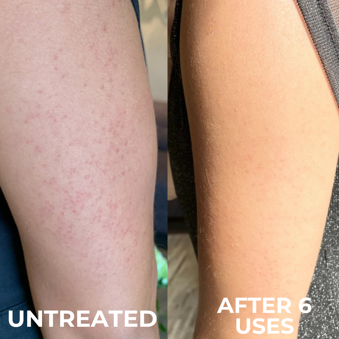 NORTH+ Smooth Defense Body Cream